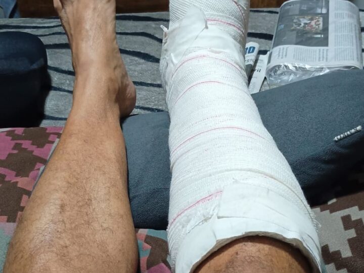 Presidente do Sindivigilância de Sorocaba é agredido em Ilha Comprida por segurança clandestino