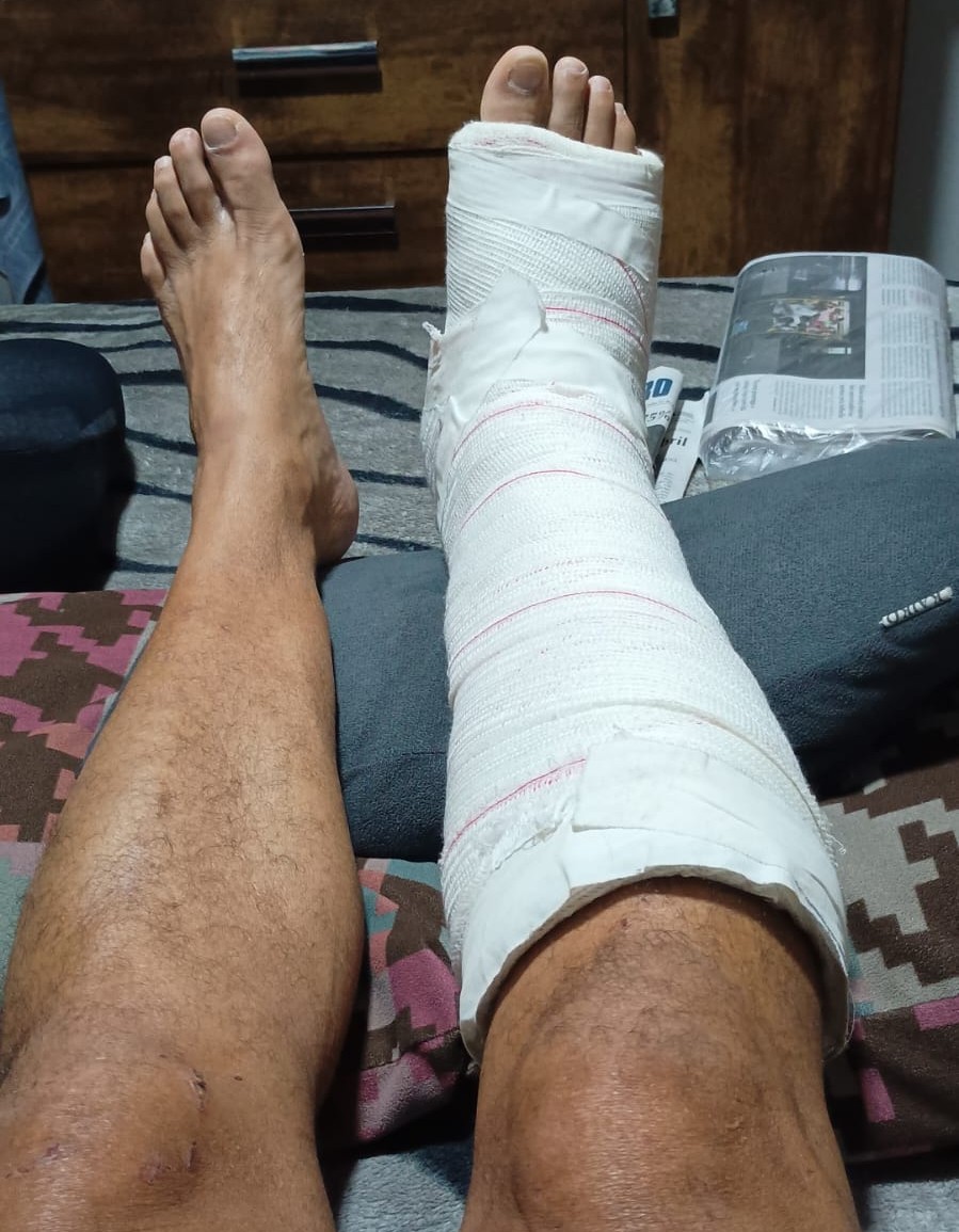 Presidente do Sindivigilância de Sorocaba é agredido em Ilha Comprida por segurança clandestino